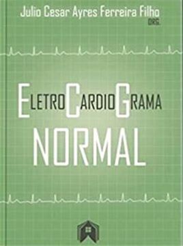 Imagem de ELETROCARDIORAMA NORMAL