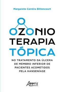 Imagem de OZONIOTERAPIA TOPICA NO TRATAMENTO DA ULCERA DE MEMBRO INFERIOR DE PACIENTES ACOMETIDOS PELA HANSENIASE