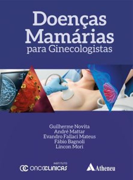 Picture of DOENCAS MAMARIAS PARA GINECOLOGISTAS