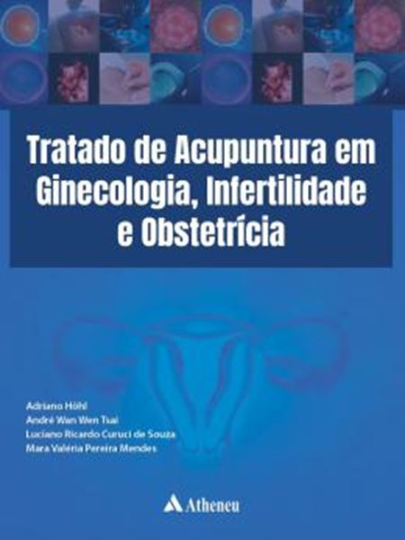 Picture of TRATADO DE ACUPUNTURA EM GINECOLOGIA, INFERTILIDADE E OBSTETRICIA