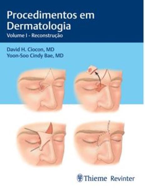 Picture of PROCEDIMENTOS EM DERMATOLOGIA