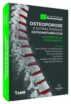 Imagem de OSTEOPOROSE E OUTRAS DOENCAS OSTEOMETABOLICAS