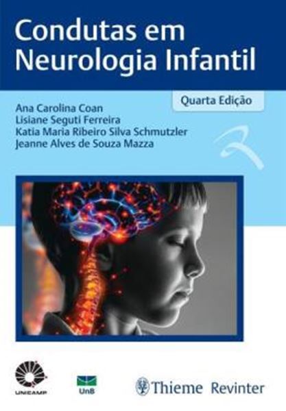 Picture of CONDUTAS EM NEUROLOGIA INFANTIL