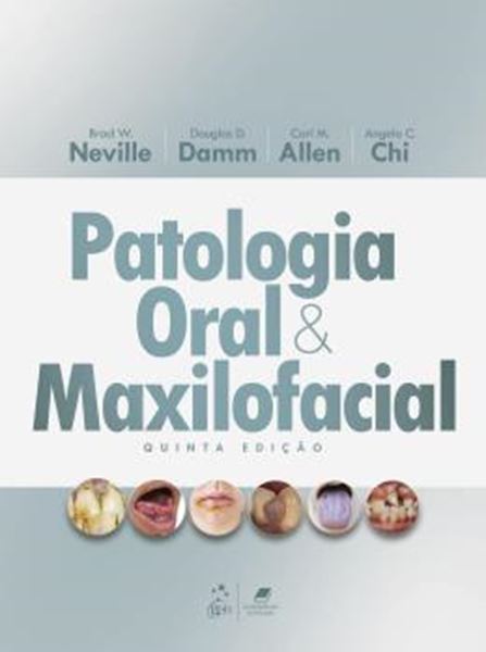Picture of PATOLOGIA ORAL E MAXILOFACIAL - 5ª ED