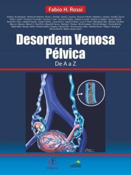 Picture of DESORDEM VENOSA PELVICA DE A A Z