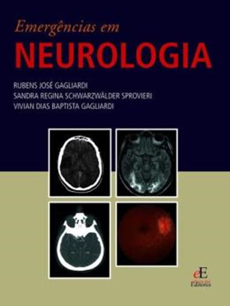 Picture of EMERGENCIAS EM NEUROLOGIA