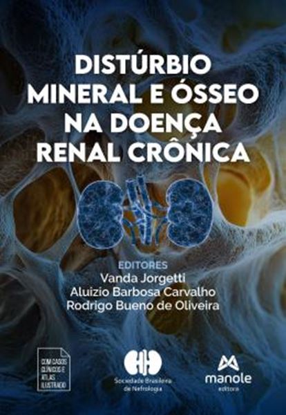 Picture of DISTURBIO MINERAL E OSSEO NA DOENCA RENAL CRONICA