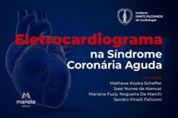 Picture of ELETROCARDIOGRAMA NA SINDROME CORONARIA AGUDA