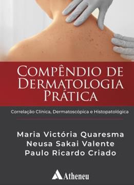 Imagem de COMPENDIO DE DERMATOLOGIA PRATICA - CORRELACAO CLINICA, DERMATOSCOPICA E HISTOPATOLOGICA