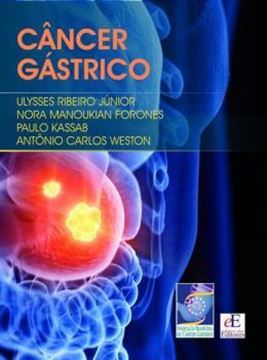 Imagem de CANCER GASTRICO