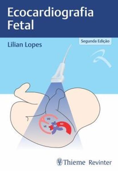 Picture of ECOCARDIOGRAFIA FETAL