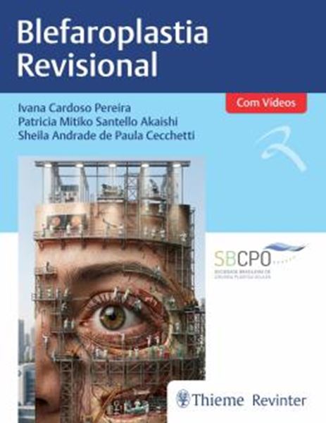 Picture of BLEFAROPLASTIA REVISIONAL