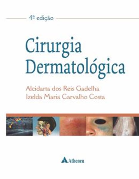 Picture of CIRURGIA DERMATOLOGICA
